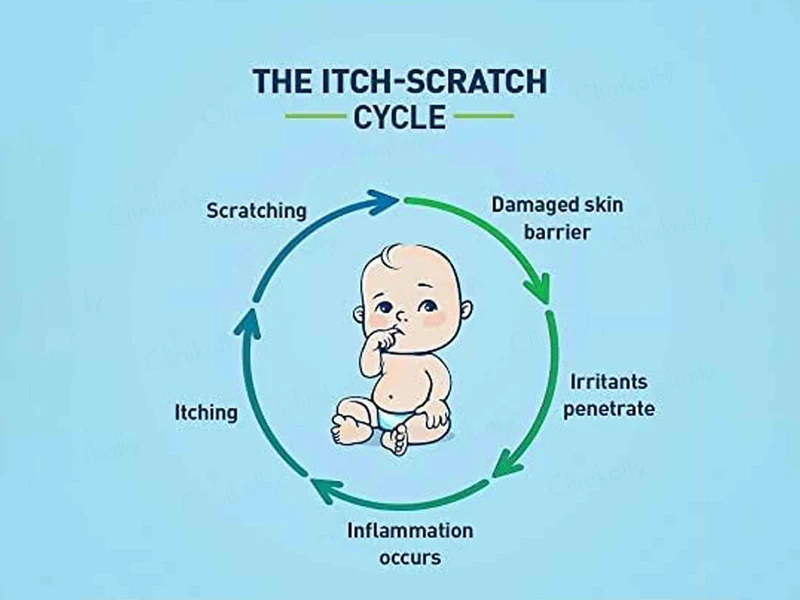 Cetaphil Restoraderm Skin Restoring Body Moisturizer - Image 4