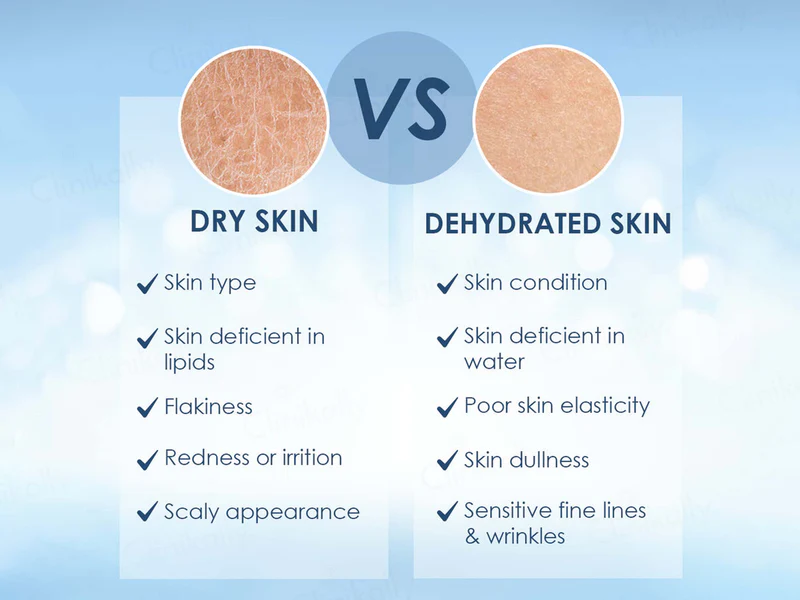 Cetaphil Optimal Hydration Daily Cream - Image 8